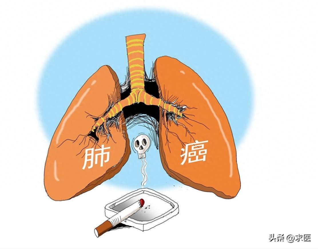 戒烟神器电子烟报价图片_戒烟心理挑战应对方法_戒烟痛苦生理心理机制